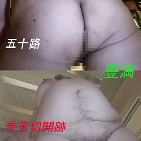 FC2-PPV-4518201 【個人撮影 初撮り】**pnsx*yxnsq 垂れ爆乳豊満熟女50歳 腹の切開跡とビラビラがエログロ！【デブ専向け】