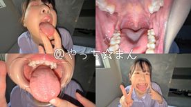 FC2-PPV-4752113 【個人撮影】谷田かりな　開口器で口内観察デカ舌を要チェック