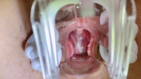 FC2-PPV-4847617 クスコで腟内丸見えオナ♡隙間からせり出す膣壁と子宮口からの生々しい分泌液